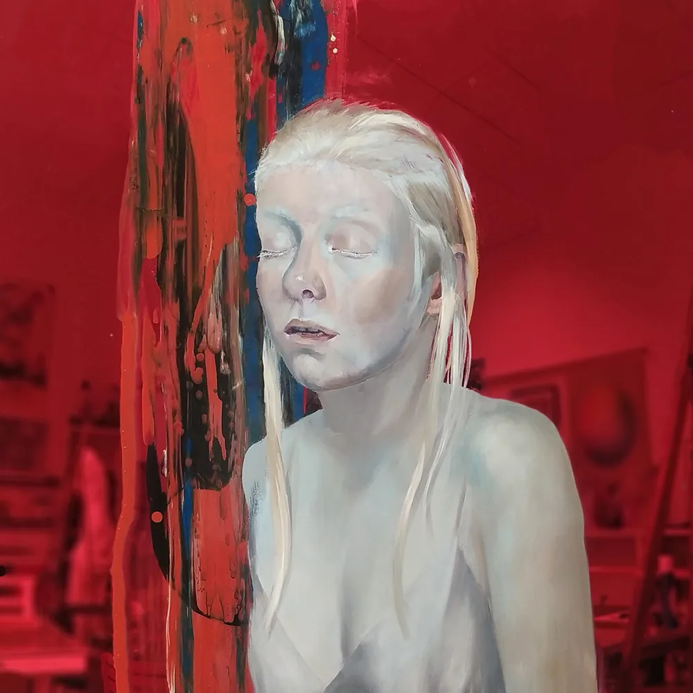 Albino 1