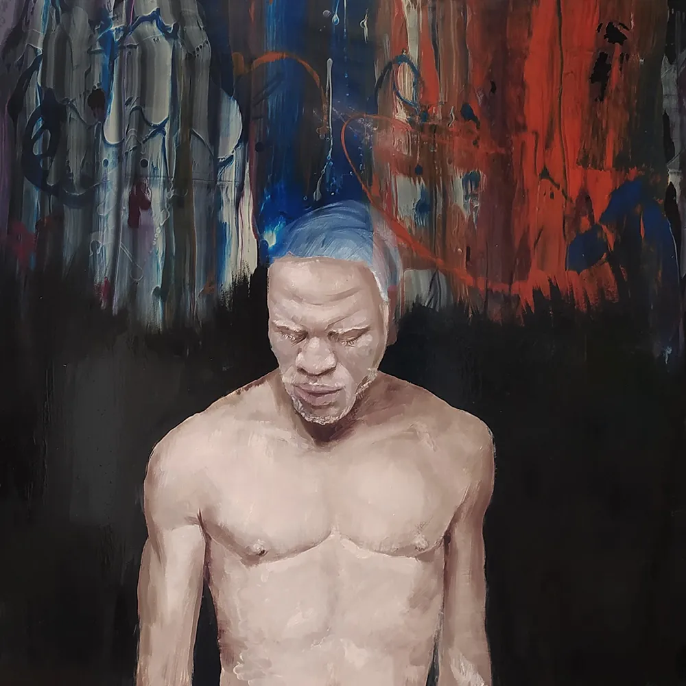Albino 2